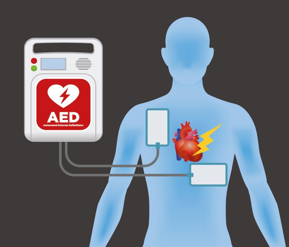 Automated External Defibrillator (AED) - VIEW PLUS for sale in Thiruvananthapuram